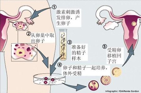 助孕儿子包成功